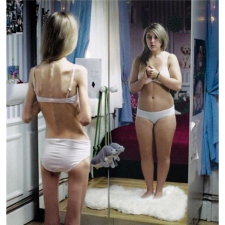 Anorexia 2