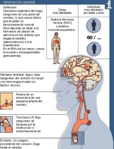 accidente-cerebrovascular-2