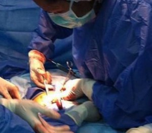 Operacion