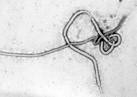 Tras los análisis de ocho muestras, el Instituto nacional de investigación biomédica confirmó que dos son positivos