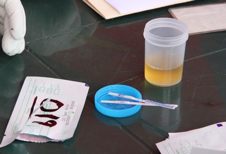 Pruebas Toxicologicas