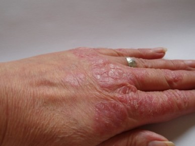 Skin Camouflage photo 1