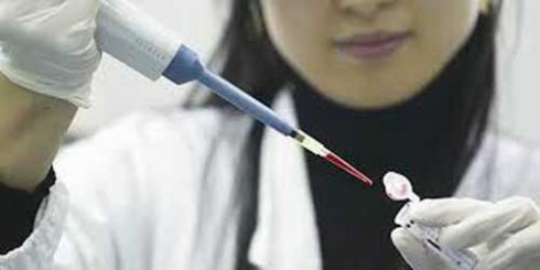 80 % de los insumos que requieren los laboratorios para hacer perfiles, son de manufactura nacional.