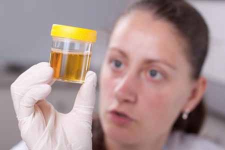 El color de nuestra orina puede ser de lo más elocuente si lo que estamos buscando es analizar nuestro estado de salud.